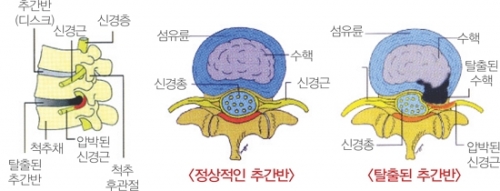 (사진=가천의대길병원 홈페이지)