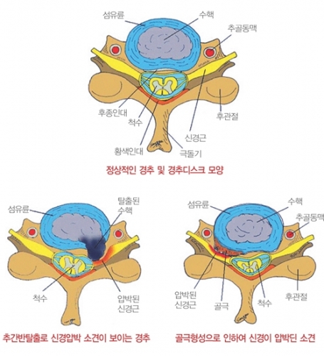 (사진=가천의대길병원 홈페이지)