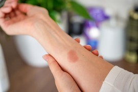 “편리함 뒤에 숨은 불편”…짚어봐야 할 음식물처리기 안전사고