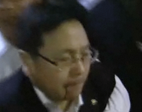 한나라당 김성회 의원에게 얼굴을 가격당해 피를 흘리는 강기정 의원. (